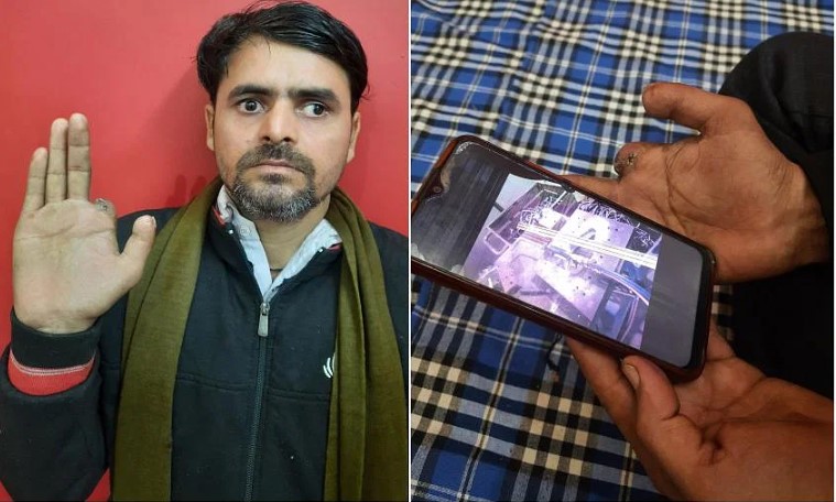 Ông Devinder Sharma bị mất ngón trỏ phải và một phần ngón cái khi đang làm việc với máy ép điện ở Faridabad, miền bắc Ấn Độ vào ngày 9/9. ẢNH ST: DEBARSHI DASGUPTA